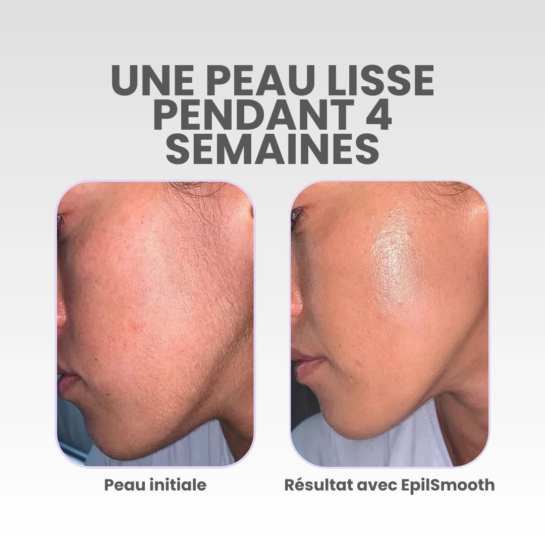EpilSmooth⎪Épilateur visage